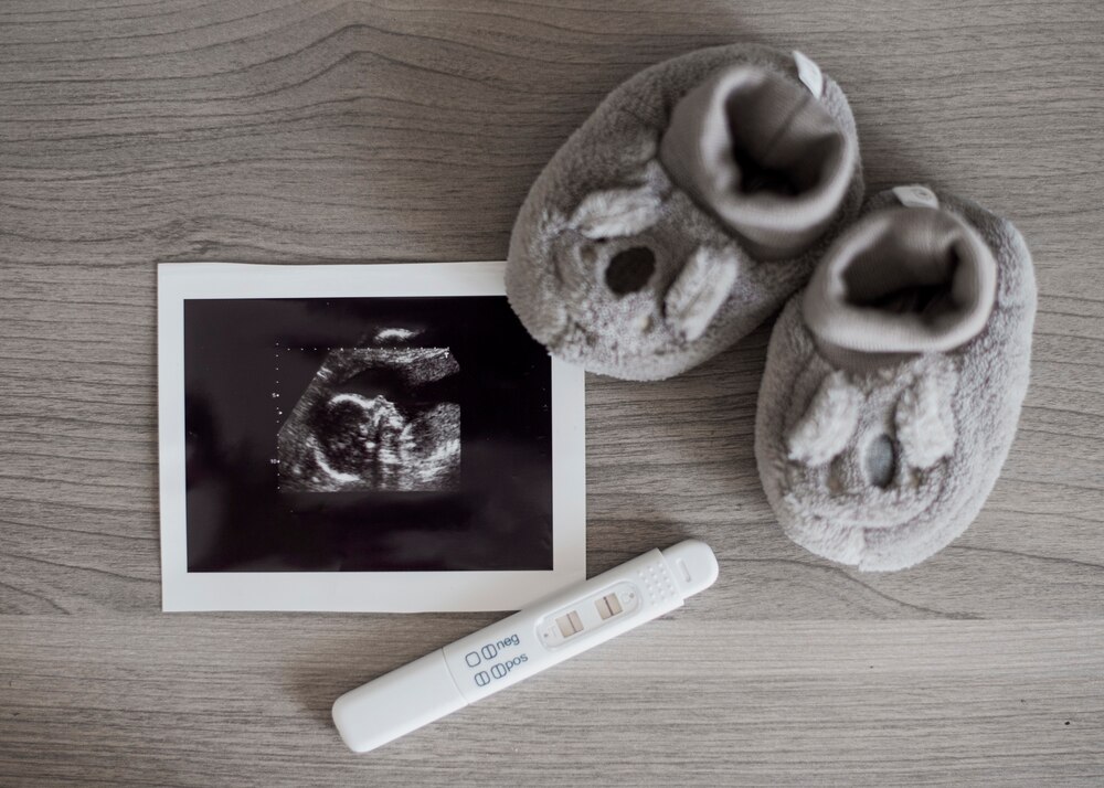 Complete Guide: How To Prepare For a 3D/4d Ultrasound
