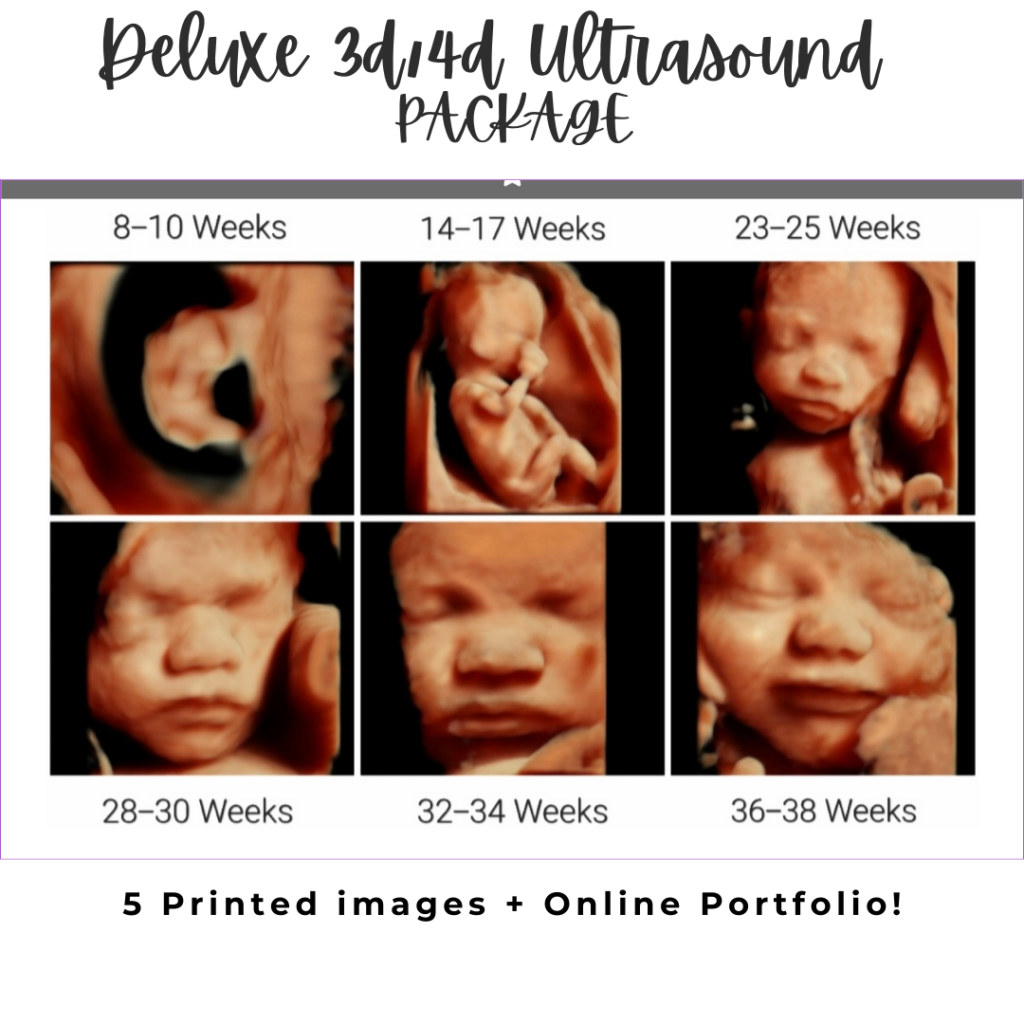 3d/4d 5D Ultrasound Sonogram