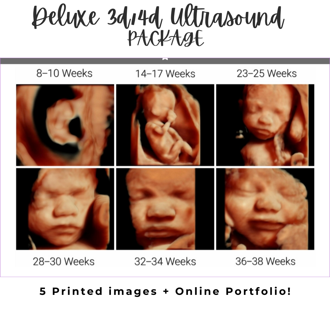 3d/4d 5 D Ultrasound