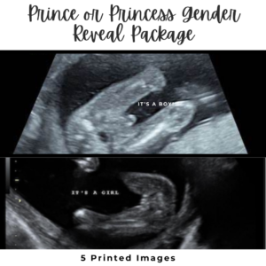 Gender Reveal Ultrasound