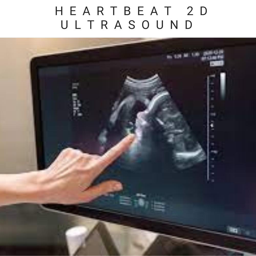 Heartbeat Ultrasound