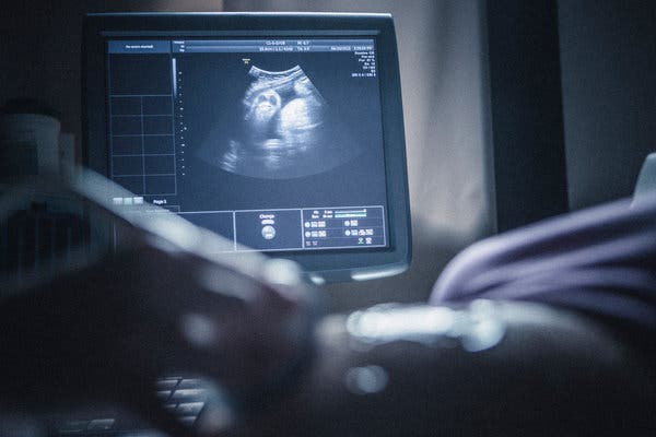 Are Sonograms Bad for Babies?