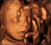 Can You See Eye Color On 4D Ultrasound?