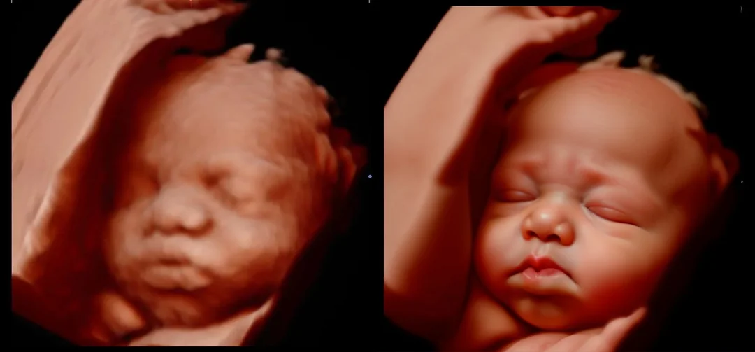 Does 4D Ultrasound Show Skin Color?