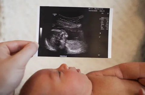 4D Ultrasound!