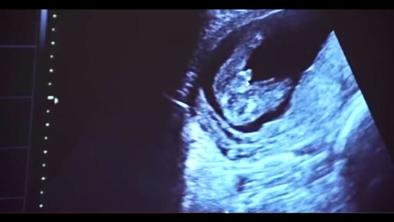 4D Ultrasound Gender Reveal Adventure!
