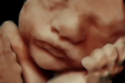 3D Sonogram