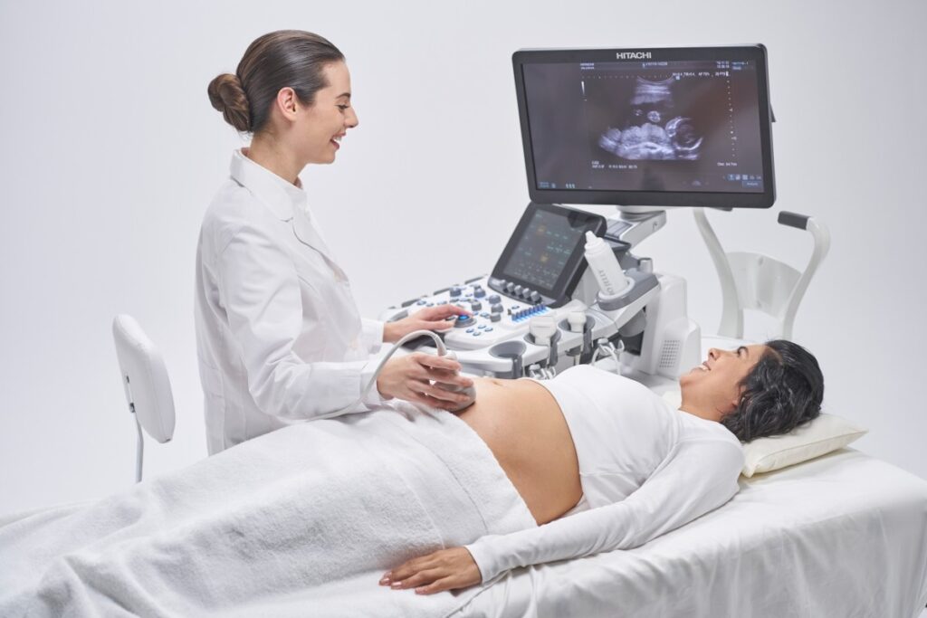 4D Ultrasound