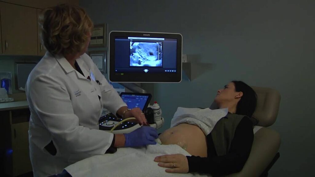 Best 4D Ultrasound