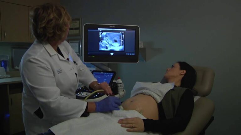 Best 4D Ultrasound